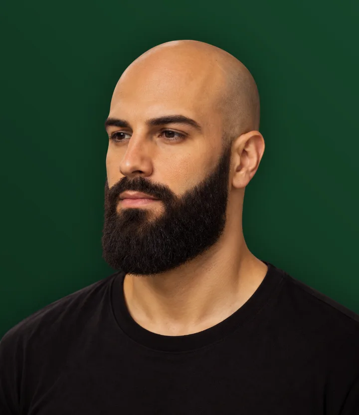 Homem careca com barba comprida e volumosa